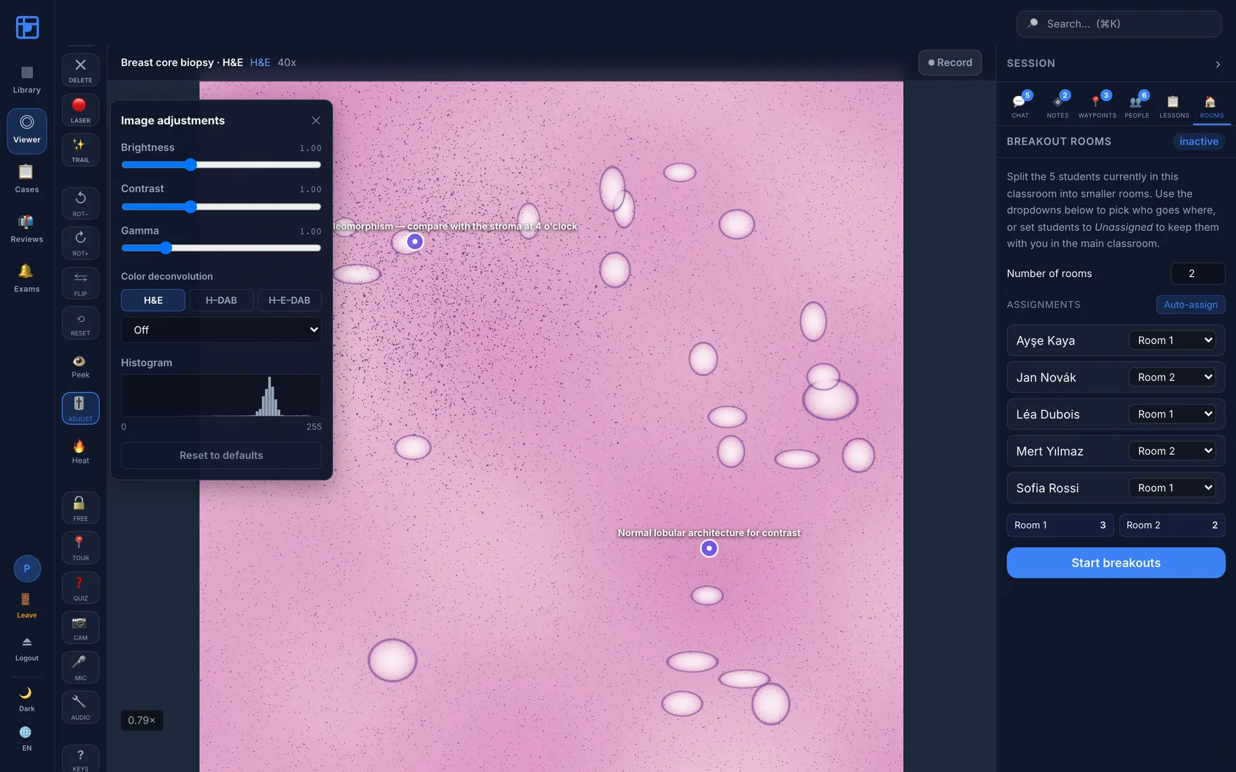 Image adjustments panel with brightness, contrast and gamma sliders, colour deconvolution selector and a live histogram.