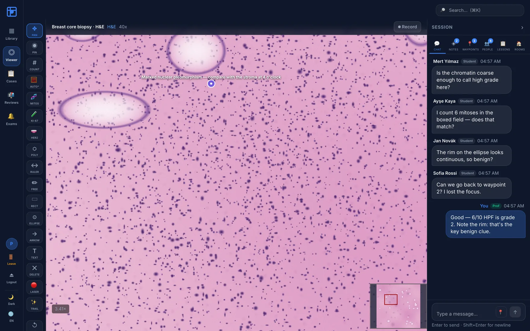 DiHiPa whole-slide viewer during a live teaching session: annotation pinned on the lesional focus with student discussion in the side panel